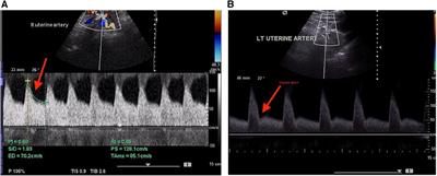 Color Doppler ultrasound in high-low risk pregnancies and its relationship to fetal outcomes: a cross-sectional study